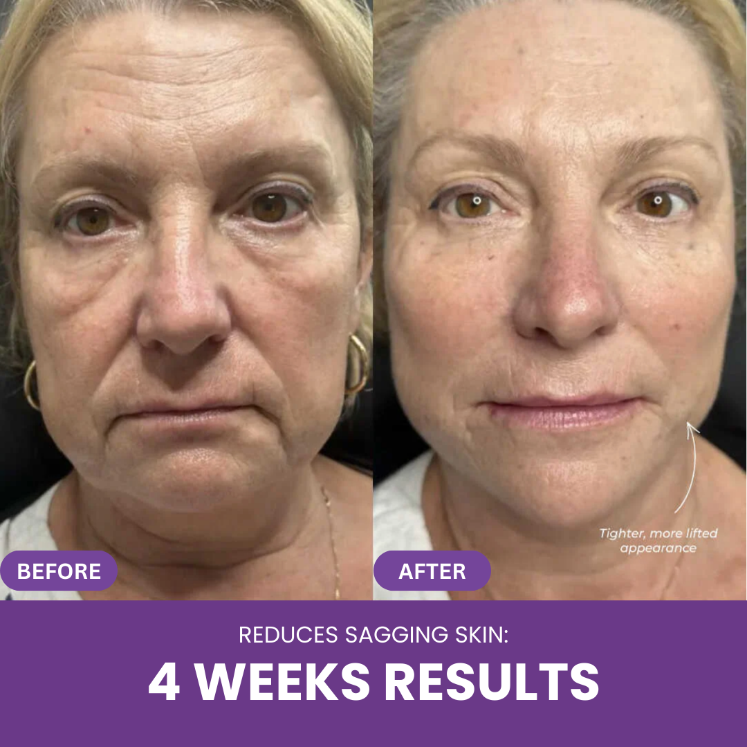 Nextrena™ Radiance Roller