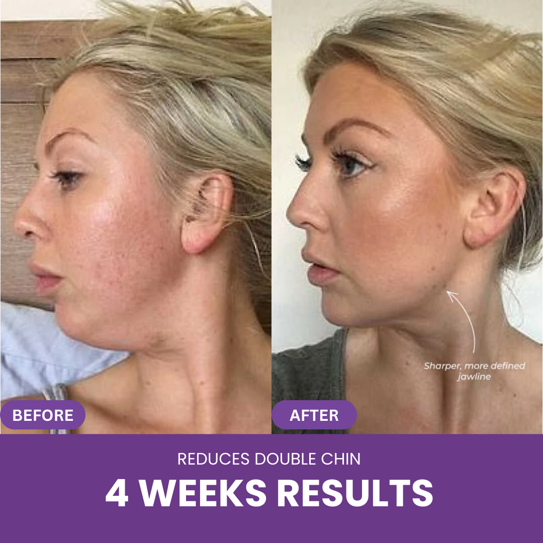 Nextrena™ Radiance Roller