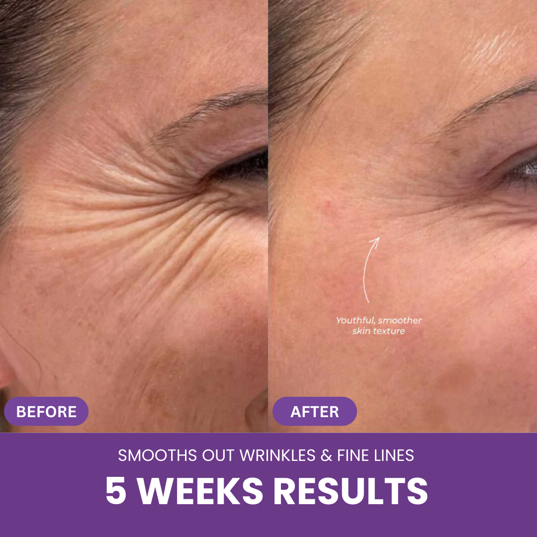 Nextrena™ Radiance Roller