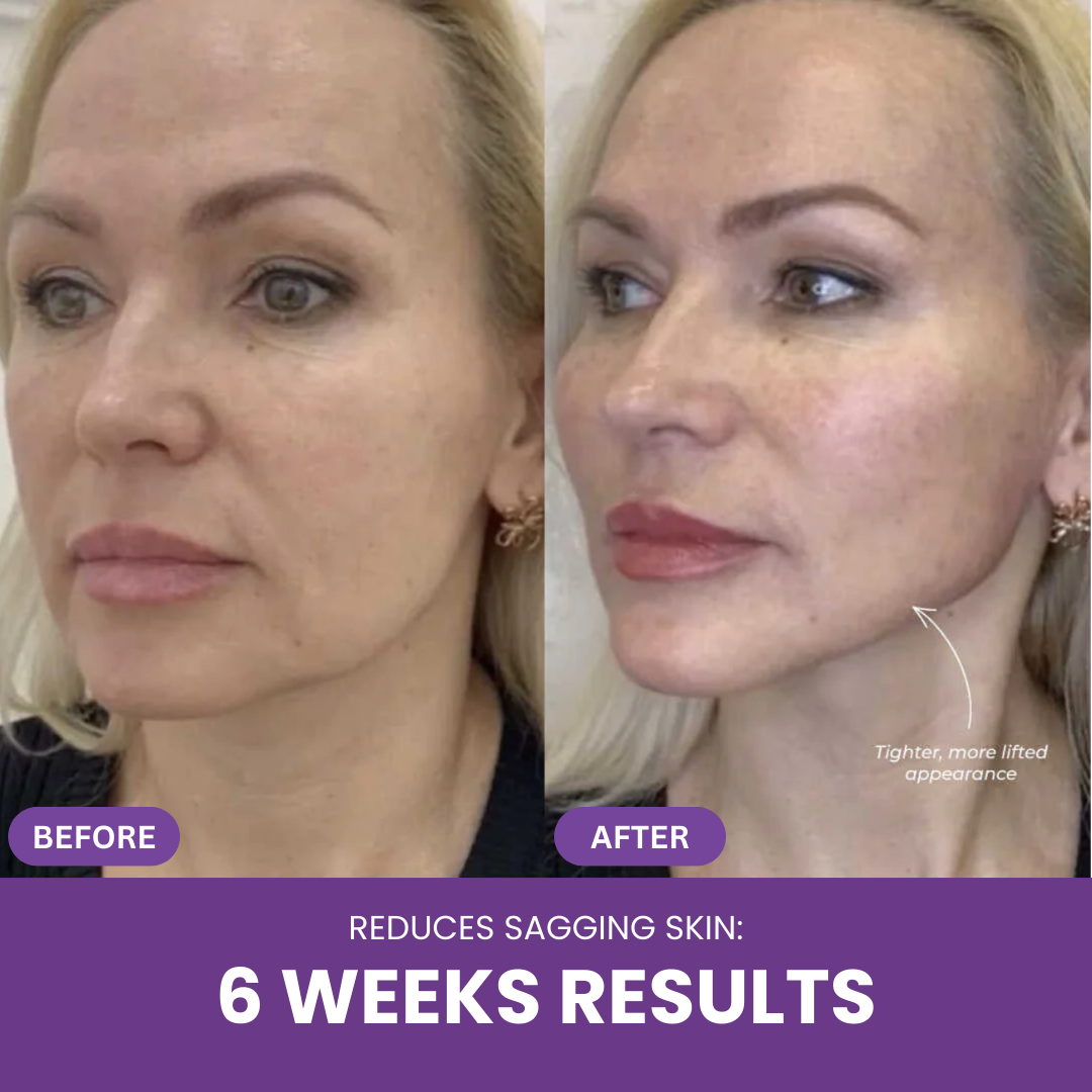 Nextrena™ Radiance Roller
